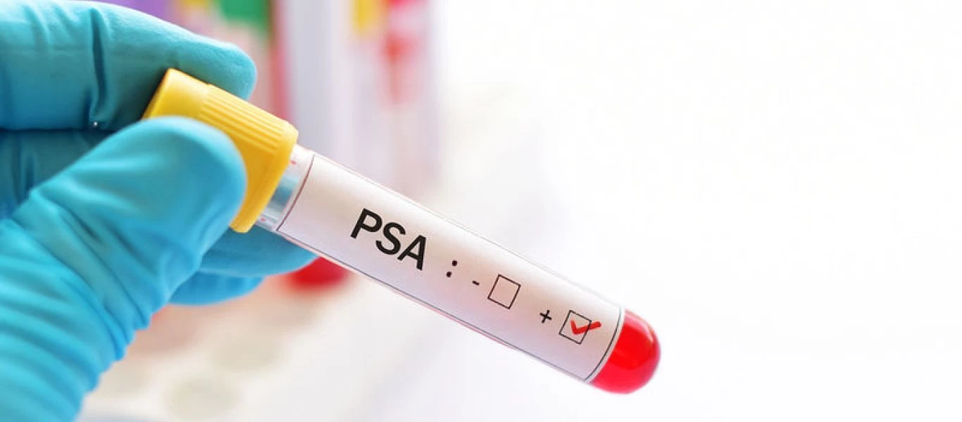 Ποιοι άνδρες κινδυνεύουν από καρκίνο του προστάτη;